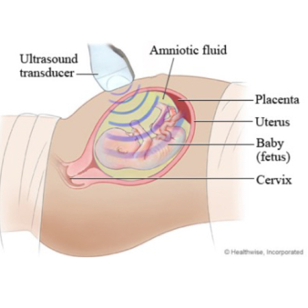 fetal ultrasound